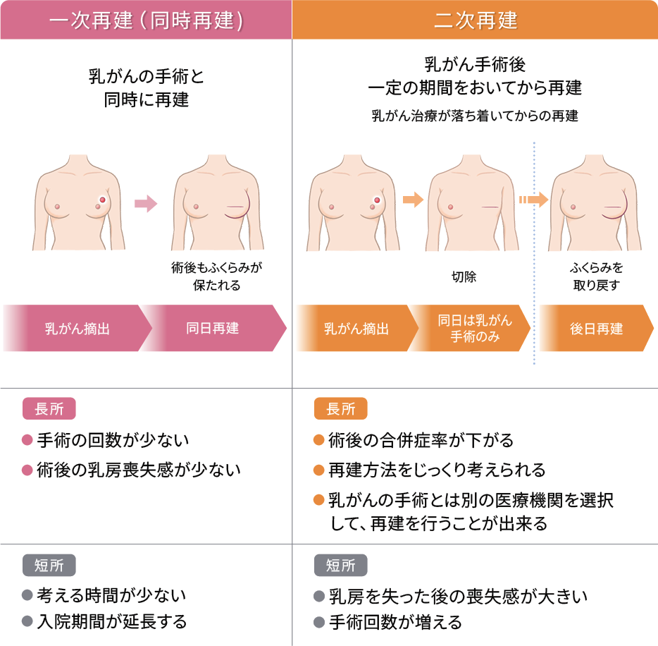 一次再建、二次再建